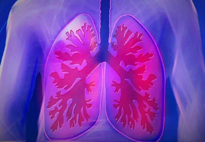 Fibrosis quística: quién la descubrió y el impacto de su hallazgo