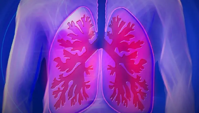 Fibrosis quística: quién la descubrió y el impacto de su hallazgo